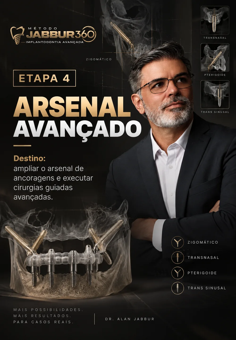 Etapa 4 — Arsenal Avançado